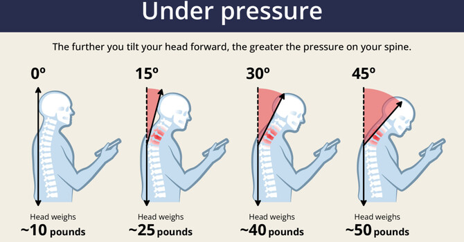 Tech Neck in Waukee: How Your Chiropractor Can Fix It